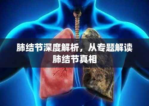 肺结节深度解析,从专题解读肺结节真相