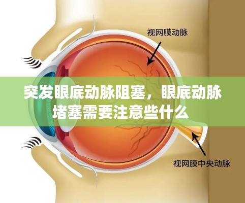 突发眼底动脉阻塞,眼底动脉堵塞需要注意些什么