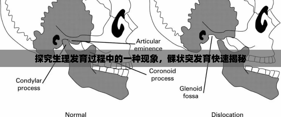 探究生理发育过程中的一种现象,髁状突发育快速揭秘