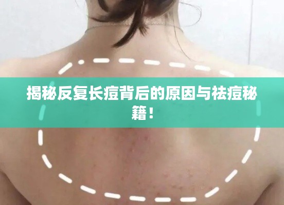 揭秘反复长痘背后的原因与祛痘秘籍!